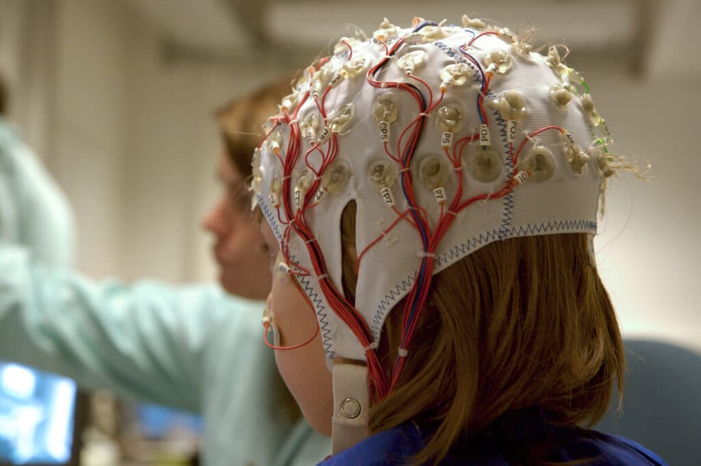 girl with eeg wire cap on for brain mapping therapy